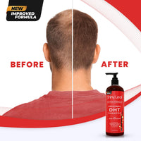 DHT Blocker Hair Loss Shampoo with Biotin — 16 oz