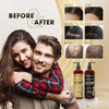 DHT Pro Shampoo and Conditioner with Procapil and Capixyl