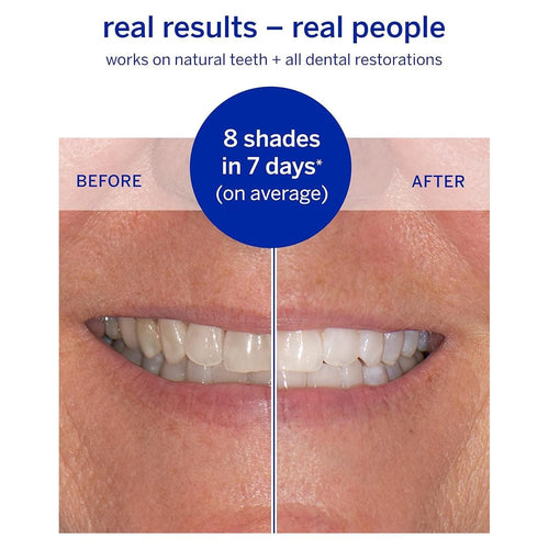 Supersmile Superstrips Teeth Whitening Dissolving Strips 14