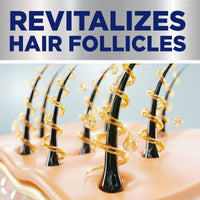 Equate Minoxidil Topical Solution USP, 5 Percent, Extra Strength 2 oz EasyOptionXY LLC