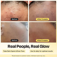 Advanced Brightening Moisturizer Gleamin