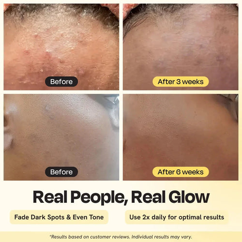 Advanced Brightening Moisturizer Gleamin