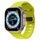 shiny yellow / 38mm 40mm 41mm (42mm S10 & S11)