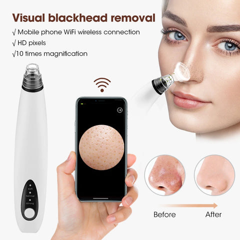 Wireless Camera Visual Blackhead Remover Facial Deep Cleaning Acne Black Spots Strong Vacuum Suction Device Skin Care