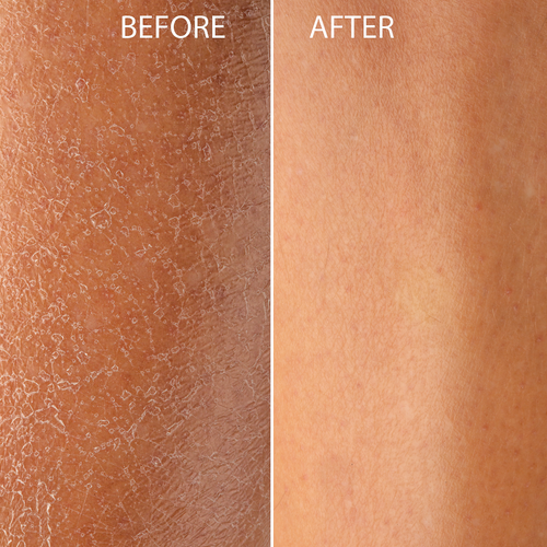 Cellular Renewal Methylene Blue Body Lotion