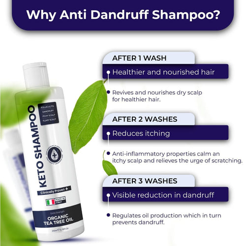 Anti Dandruff Shampoo Sulfate Free Shampoo Medicated Anti Fungal Shampoo For Itchy Flaky Dry Scalp Hair Growth Folliculitis Treatment Seborrheic Dermatitis Shampoo with Tea Tree Oil EasyOptionXY LLC
