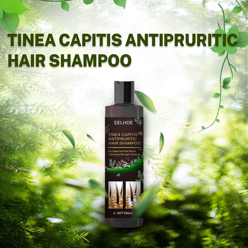Anti-Dandruff Shampoo,Shampoo For Scalp Prone To Folliculitis, Dermatitis, Dandruff, Itchy And Flaky Scalp,Treats Dandruff And Seborrheic Dermatitis,Anti-Itch Shampoo EasyOptionXY LLC