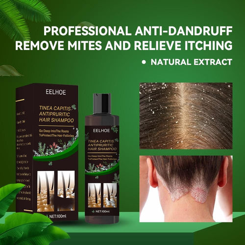 EELHOE Anti-Dandruff Shampoo - Itch Relief, Hair Loss Prevention, Oil Control & Refreshing Care EasyOptionXY LLC