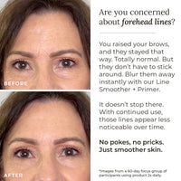 Line Smoother + Primer with Neodermyl®